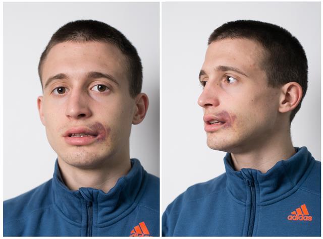 Fotografije brutalnosti prema igraču Borca 1 aleksa
