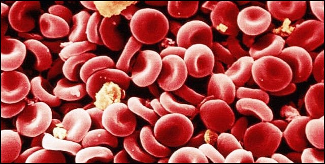 sepsa-2