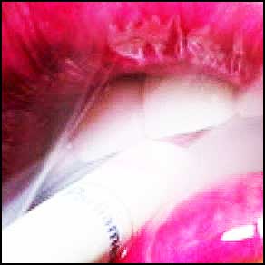 usne