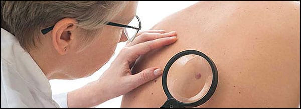 pregled-dermatoloski