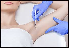 botox-za-znojenje