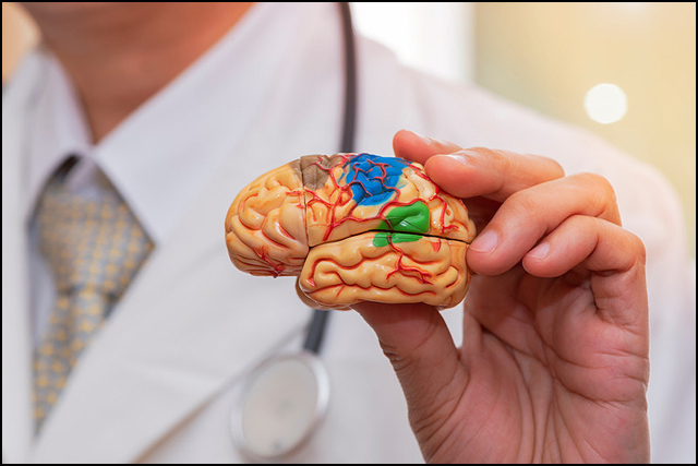 Neurologija uspeha: od dijagnoze do lečenja milijarde ljudi u svetu