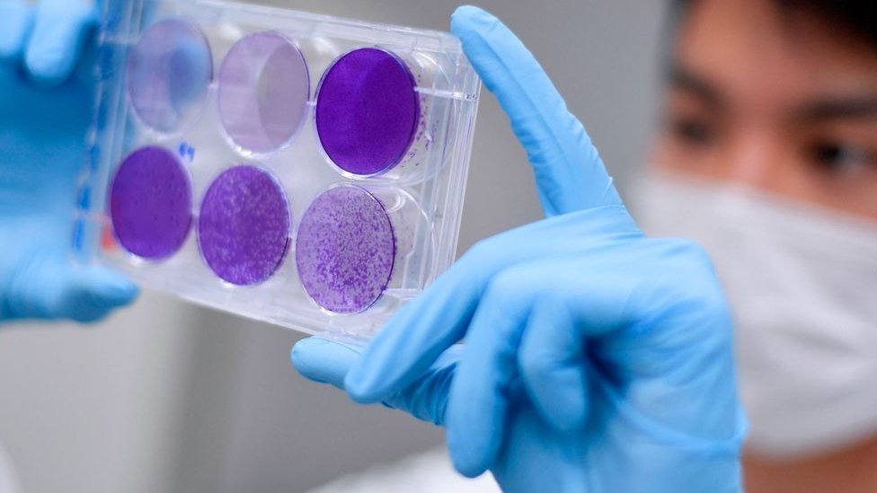 Korona virus i vakcine: Šta sam saznao kao učesnik testova u Oksfordu 1 Sledeći korak je proširivanje proba sa većom dozom na više hiljada ljudi