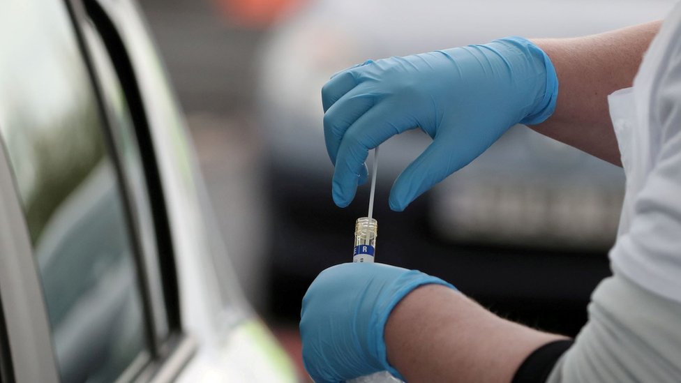 Korona virus: U Srbiji se epidemija naizgled smiruje, šest meseci nakon proglašenja globalne pandemije 1 Covid19 testing