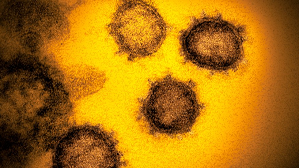 Korona virus: Zašto neki ljudi imaju teži oblik bolesti - odgovor je u genima 1 A close-up of the coronavirus which causes Covid-19