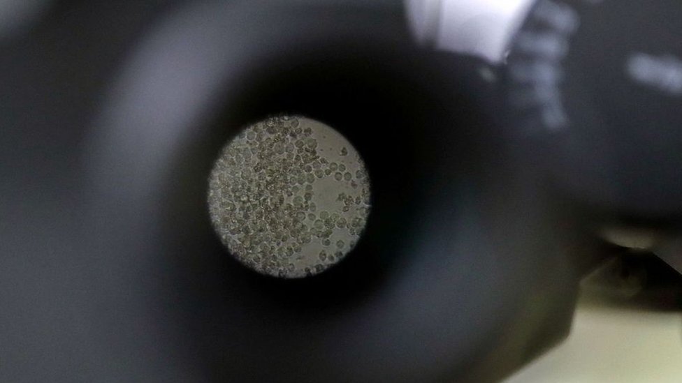 Korona virus: Šta ako niste razvili antitela posle vakcine - ima nešto što vas štiti 3 T-ćelije mogu se zadržati u telu godinama nakon što infekcija prođe, obezbeđujući tako dugotrajnu memoriju imunskom sistemu