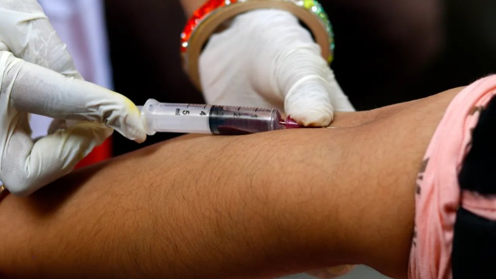 Korona virus i HIV: Pacijenti otporni na bolest otkrivaju slabe tačke Kovida-19 3 Početkom pandemije, lekari su počeli da primećuju obrasce između određenih krvnih grupa pacijenata i težine bolesti