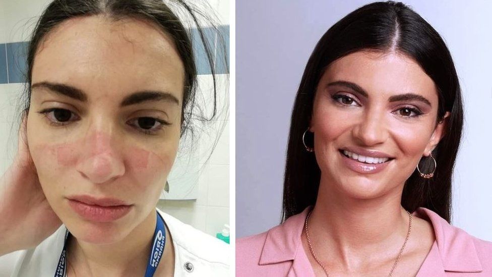 Međunarodni dan medicinskih sestara: Požrtvovanost, snaga i strah šta će biti posle pandemije 4 Martina Benedeti