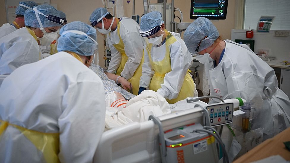 Korona virus: Drugi najcrnji dan u Srbiji od početka pandemije, u Hrvatskoj prvi slučaj Delta plus soja, iz SZO kažu da je Evropa ponovo žarište 1 bolnica, pacijent