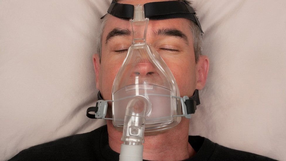Veštačka pluća i korona virus: Kako radi mašina koja diše umesto pacijenta 1 muškarac sa maskom na lečenju