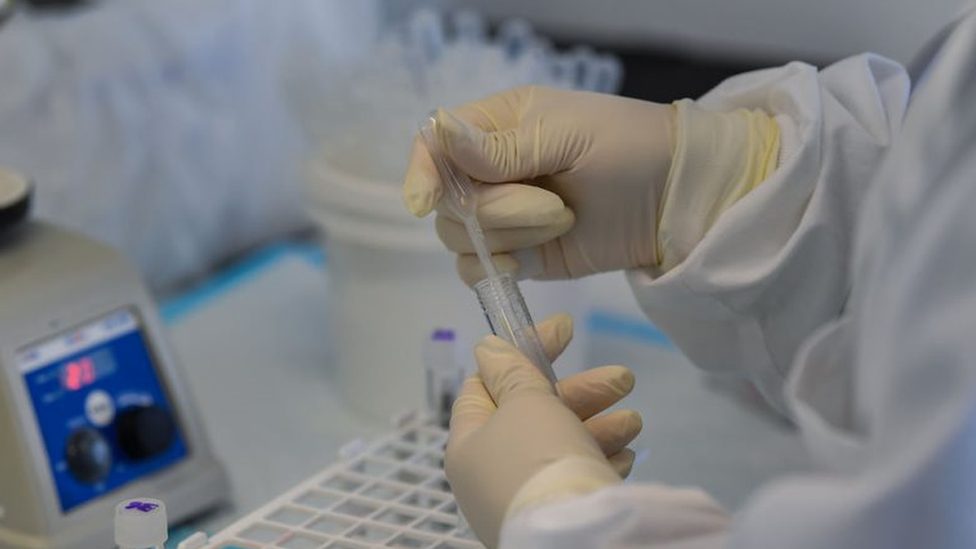 Korona virus i nauka: Odakle potiče omikron soj i kako je nastao 2 A lab worker analyses Covid-19 tests