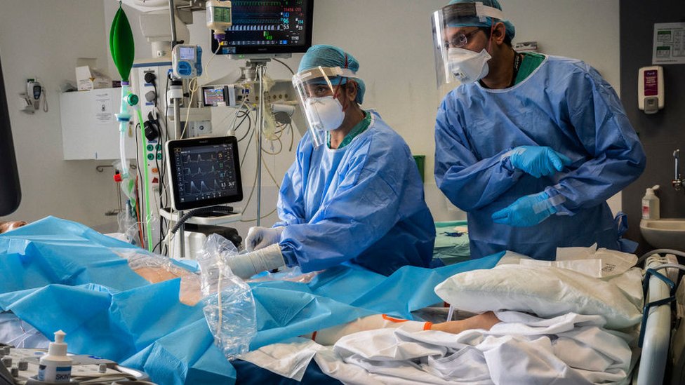 Korona virus i zdravlje: Rizik od krvnog ugruška u plućima kod ljudi sa težom kliničkom slikom 290 puta veći od normalnog 1 Doctors treating a Covid patient in ICU