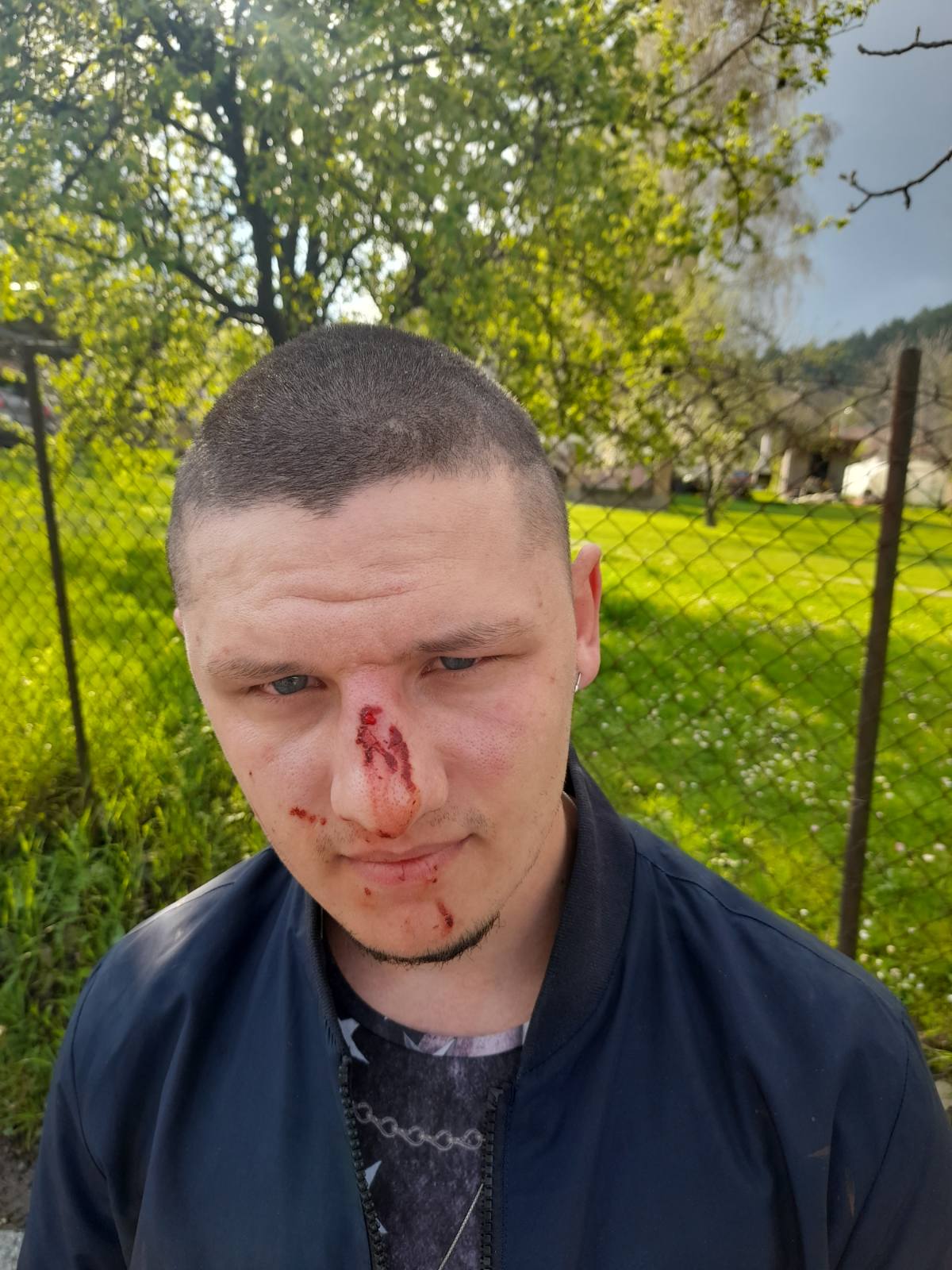 pretuceni mladic