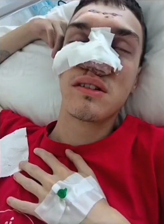 luka povredjeni