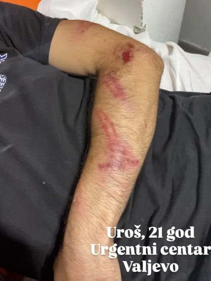 Državni terorizam nad građanima 2 valjevo 1