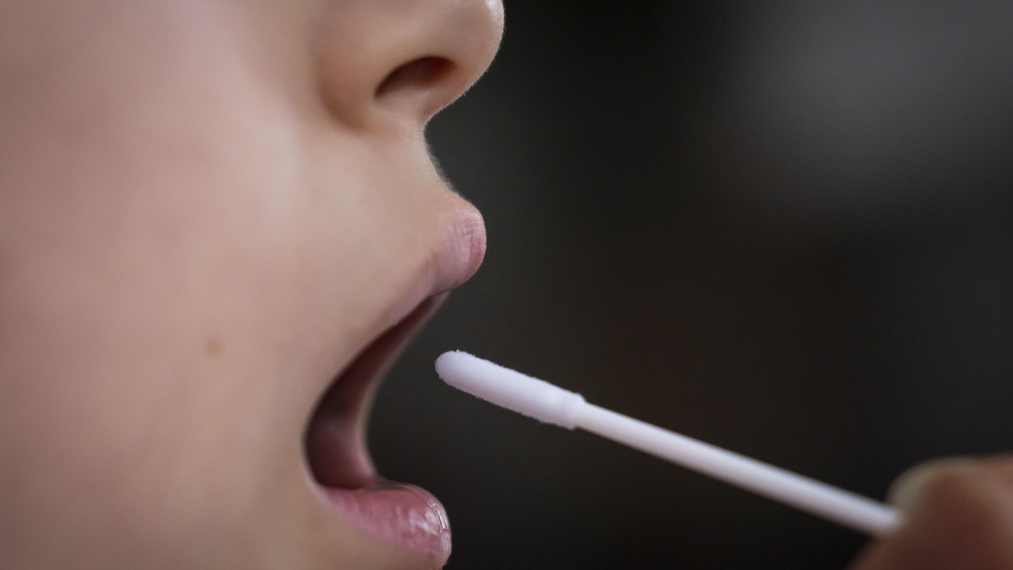 Koronavirus u Srbiji: Pacijenata sve više, simptomi blagi 1 Otvorena usta i štapić za uzimanje brisa